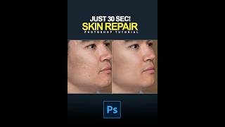 Just 30 Sec Repair Skin in Photoshop  Photoshop Shorts [upl. by Uella]