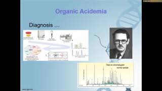 Organic Acidemia Overview and clinical presentation Dr Maha Alotaibi [upl. by Bollinger]