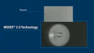 MOSES™ 20 Technology Holmium Bubble for Lithotripsy [upl. by Dranek933]