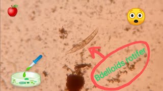 Bdelloids rotifer Tekerlekliler [upl. by Hollis]