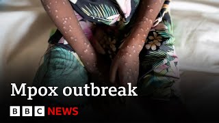 What is mpox and how is it spread  BBC News [upl. by Eniamurt]