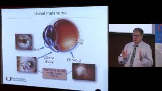 SAT  2  Current State of Uveal Melanoma Harbour [upl. by Mella487]