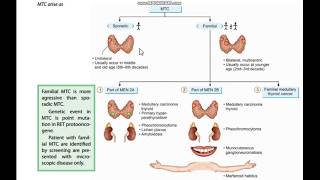 Thyroid cancer  Follicualr and Medullary [upl. by Yattirb]