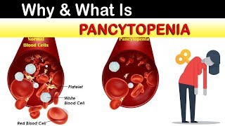 Why amp What Is Pancytopenia [upl. by Zaller]