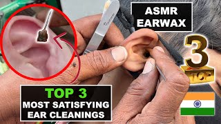 Ear Cleaning On Indian Street Top 3 of February Big black earwax pieces Asmr ear cleaning [upl. by Bogey]