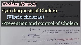 CholeraPart2  Lab diagnosis of Cholera  Prevention and control of Cholera [upl. by Morrison]