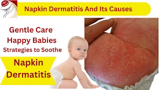 Napkin Dermatitis  And Its Causes [upl. by Petrie838]