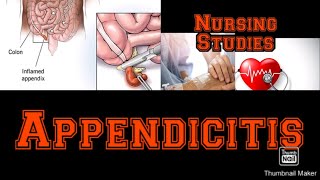 Complete lecture on Appendicitis  Pathophysiology  Medical Surgical nursingstudies [upl. by Grantland43]