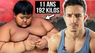 192 KILOS À 11 ANS  Lenfant le plus gros du monde [upl. by Lleznol]