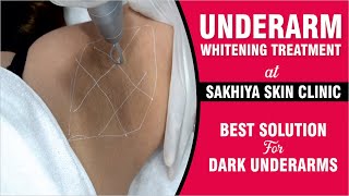 Underarm Whitening Treatment at Sakhiya Skin Clinic  Best Solution for Dark Underarms [upl. by Asle]