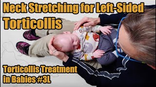 3L Neck Stretches for Leftsided Torticollis Torticollis Treatment in Babies [upl. by Eniamirt987]