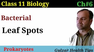 Bacterial leaf spots  causessymptomstransmission and treatment  Class 11 biology [upl. by Paley]