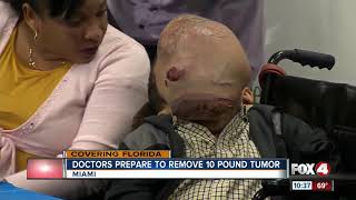 Doctors in Florida to Remove 10pound Tumor from Boys face [upl. by Mallin]