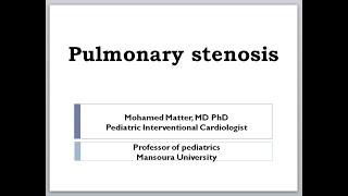 pulmonary stenosis [upl. by Fabien436]