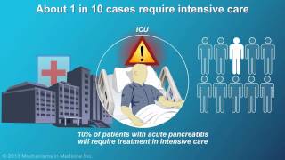 Management and Treatment of Acute Pancreatitis [upl. by Muhcon]