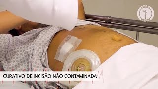 Curativo de incisão não contaminada  Sua Saúde na Rede [upl. by Nelon701]