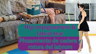 EP 0  Hip impingement and labral tear  Pinzamiento de cadera y rotura del labrum  TRAILER [upl. by Helprin911]