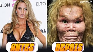 7 cirurgias plásticas em famosos que foram um desastre [upl. by Stryker995]