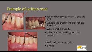 OSCE Introduction part 1 written osceORE PART 2 [upl. by Fayette487]