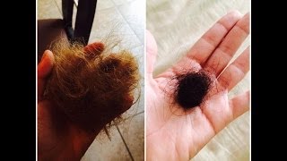 Deten la caida del cabello mi experiencia real [upl. by Januisz]