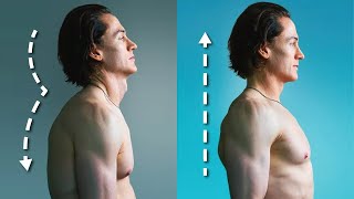 How I Fixed My Terrible Posture  5 Habits [upl. by Alesiram664]