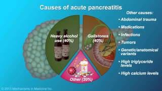 Acute Pancreatitis [upl. by Scever]