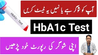 What is HbA1c Test Urdu Hindi Normal Range of HbA1c Test kya hota hai  Irfan Azeem [upl. by Ttam]