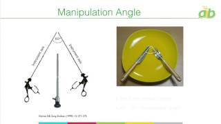 Ergonomics of Port Placement  IBC [upl. by Amado198]