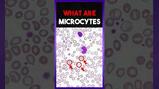 What are Microcytes [upl. by Lantz60]