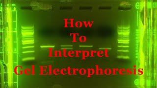 Gel Electrophoresis and Gel Analysis [upl. by Mikal]