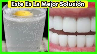 Quita el Sarro de Tus Dientes con 1 Remedio casero hecho por ti mismo [upl. by Gahan740]