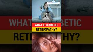 What Is Diabetic Retinopathy [upl. by Ailito]