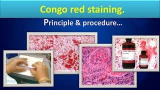 Congo red staining methodClear overviewPrincipleprocedureUses [upl. by Arias241]