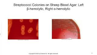 Streptococci and Related Species [upl. by Cochrane]