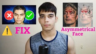 How to fix Asymmetrical  Uneven Face Naturally  How I Fixed my face Asymmetry in Just 60 Days [upl. by Jase]