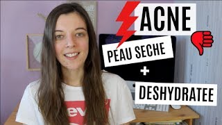 ACNE  Jai la Peau Sèche et Déshydratée AU SECOURS  😩 [upl. by Ykcor]