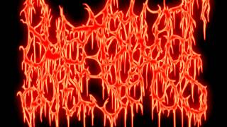 SubValvular Aortic Stenosis  Cerebral Cortical Heterotopia Unreleased Demo 2012 [upl. by Wohlen]