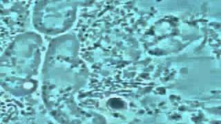 Guérir votre gencive par la microscopie entamoeba gingivalis amibe [upl. by Regnig757]