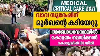 Snake Master Vava Suresh in Critical Condition Bitten by a Capturted Cobra at Kottayam [upl. by Estell]