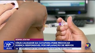 Herpes zóster vírus causador da catapora pode provocar doença responsável por inflamação de nervos [upl. by Amapuna]