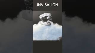 Invisalign Underbite  Time Lapse  London UK [upl. by Netsruk]