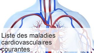 Maladies du système cardiovasculaire  liste causes et symptômes des pathologies [upl. by Nosilla]