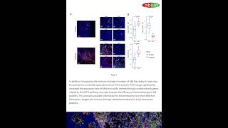 Exploring the Tumor Immune Microenvironment of Melanoma biology mihc [upl. by Anitsihc468]