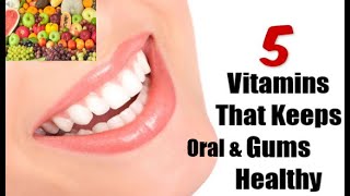 5 Vitamins that keeps oral and gum healthy [upl. by Waxman]