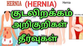 Hernia symptoms in tamilhernia symptoms for men hernia treatment in tamilhernia in tamil [upl. by Sordnaxela636]