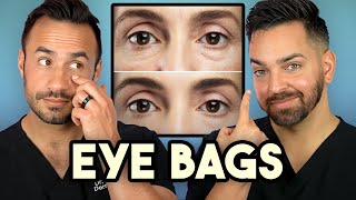 How Treat Under Eye Bags Like A Dermatologist [upl. by Anaitsirhc272]