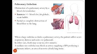 THORAX CLINICALS PPT  Part I  Dr M Kamran Ameer [upl. by Einnov705]