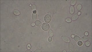 Bakers Yeast under the Microscope [upl. by Nagel856]