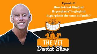 Ep 13  How to treat Gingival Hyperplasia Is gingival hyperplasia the same as Epulis [upl. by Christen]