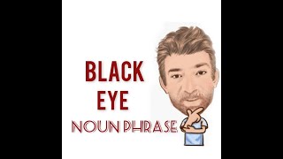 Black Eye  Noun Phrase 583 Two Meanings  English Tutor Nick P [upl. by Atin578]